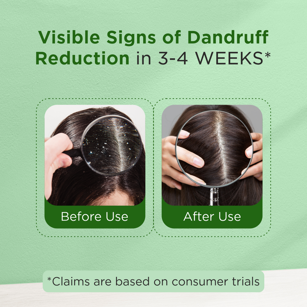 100% Natural Tea Tree Oil 100ml