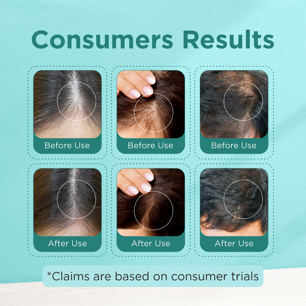 100% Natural Rosemary Essential Oil 10ml